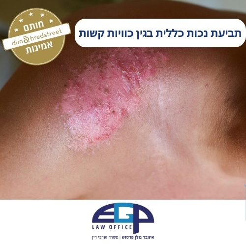 תביעת נכות כללית בגין כוויות קשות
