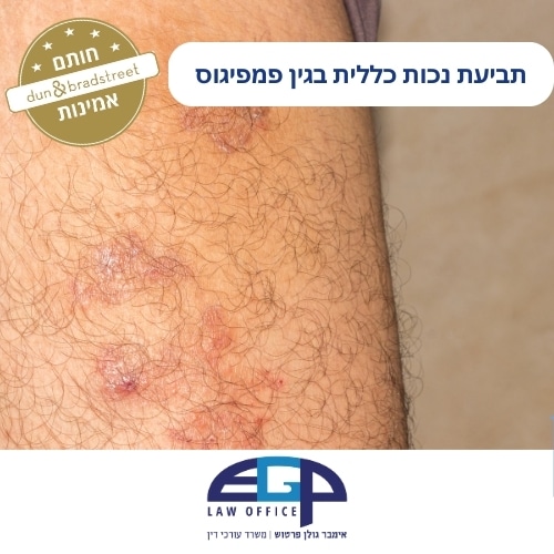 תביעת נכות כללית בגין פמפיגוס